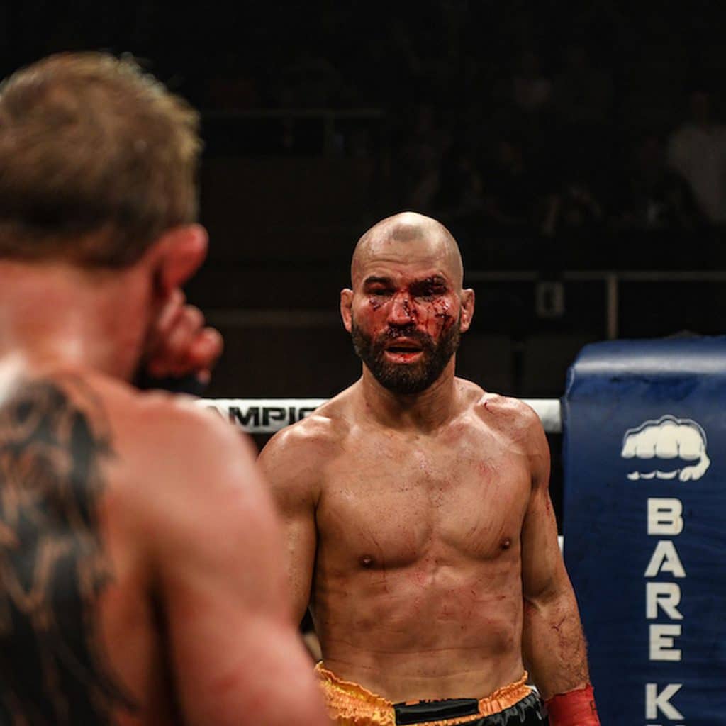 บทความมวย | Bare-knuckle Boxing